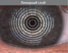 липидный слой